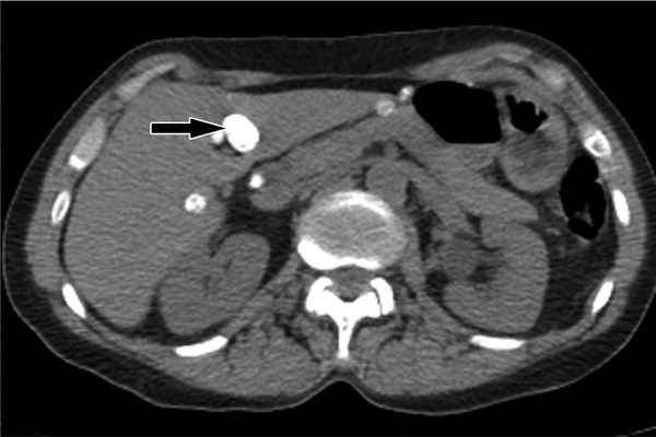 CT Scan