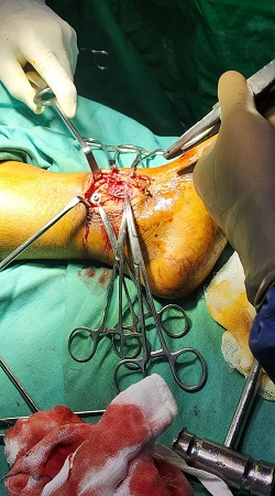 Orthopedic Treatment Pic2